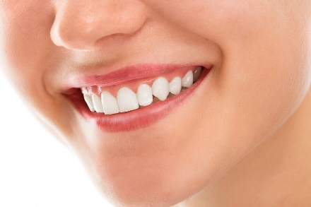 How long does cosmetic bonding last?