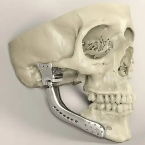 prosthodontics-2 Prosthodontics